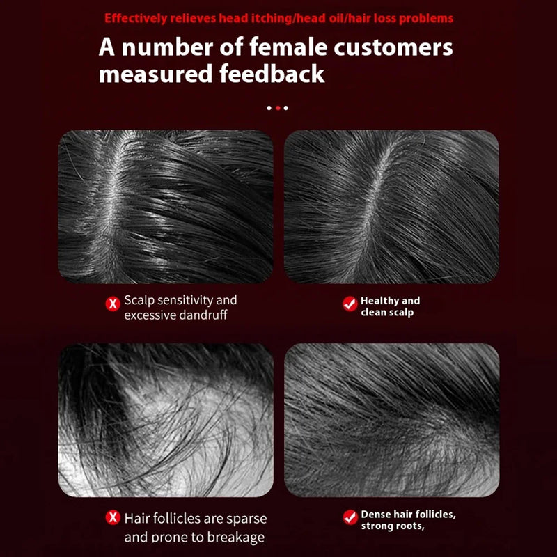 3 Modes Electric Massage Comb Portable Red Light Laser Comb for Hair Follicle Hair Follicles On The Head Essence Oil Applicator